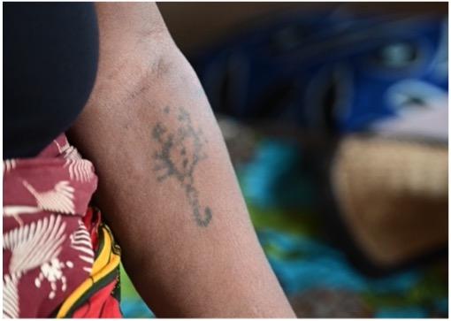 Quand la douleur ressemble à un scorpion